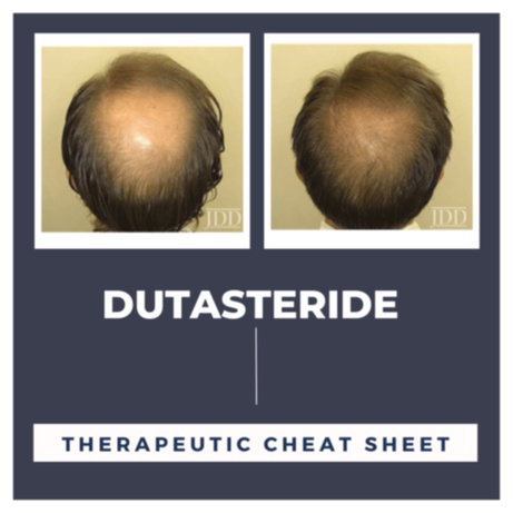 dutasteride